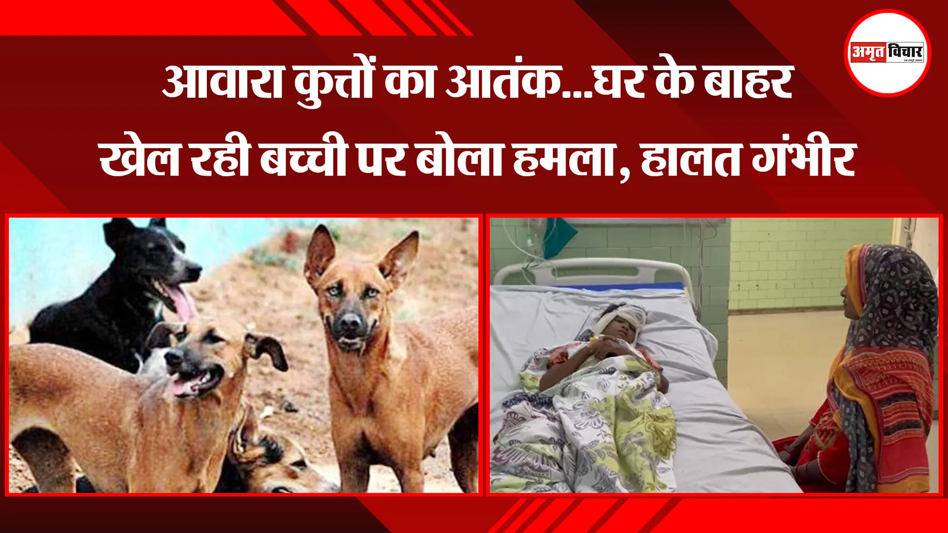 बरेली: आवारा कुत्तों का आतंक...घर के बाहर खेल रही बच्ची पर बोला हमला, हालत गंभीर