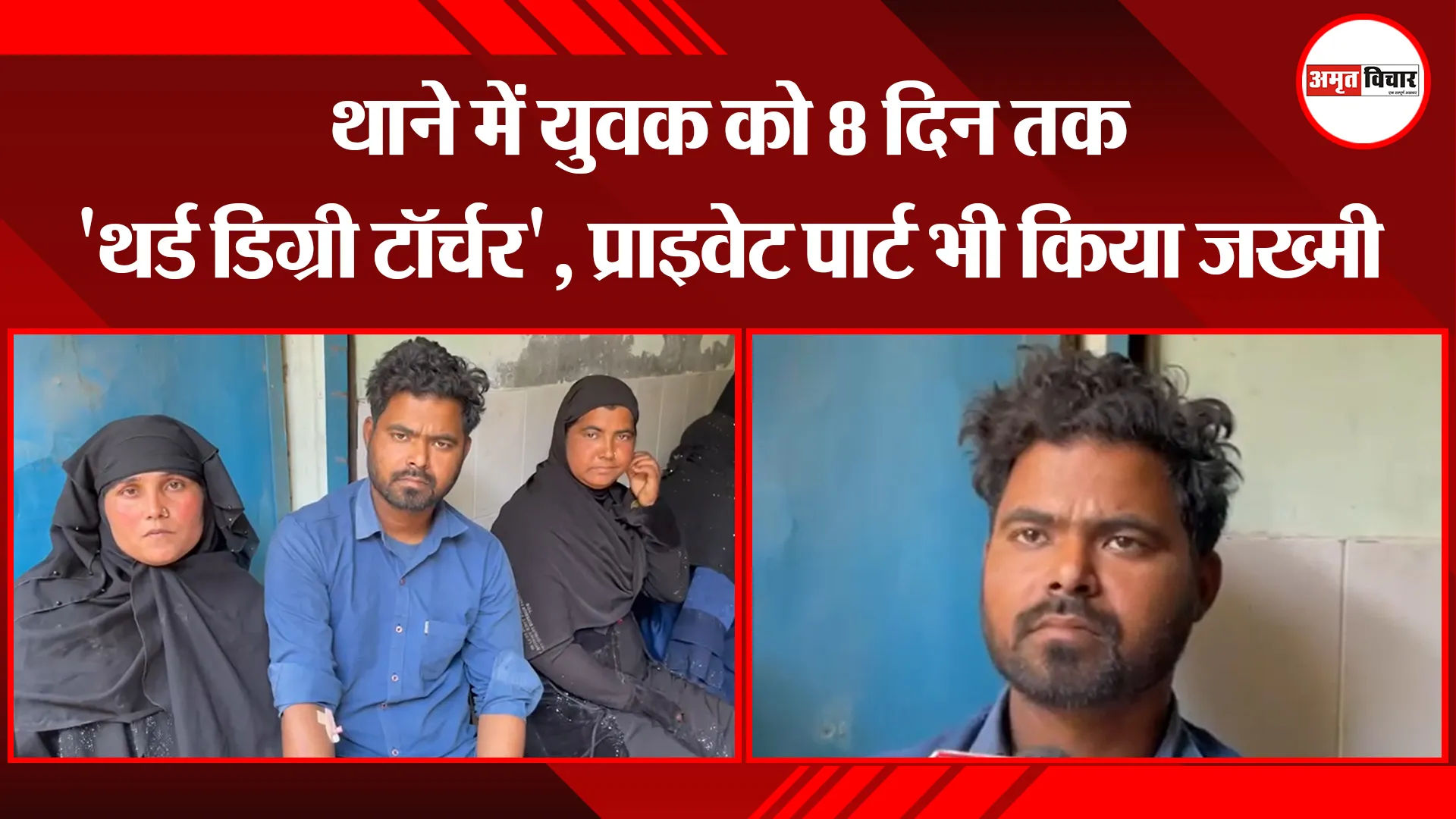 बरेली: थाने में युवक को 8 दिन तक 'थर्ड डिग्री टॉर्चर', प्राइवेट पार्ट भी किया जख्मी 