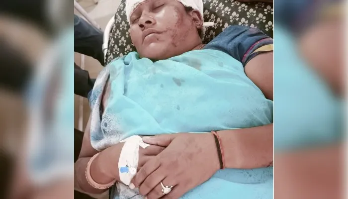 Unnao News : देवर ने भाभी पर कुल्हाड़ी से किया वार, मरणासन्न हालत में परिजन ले गए सीएचसी, हमलावर मौके से फरार