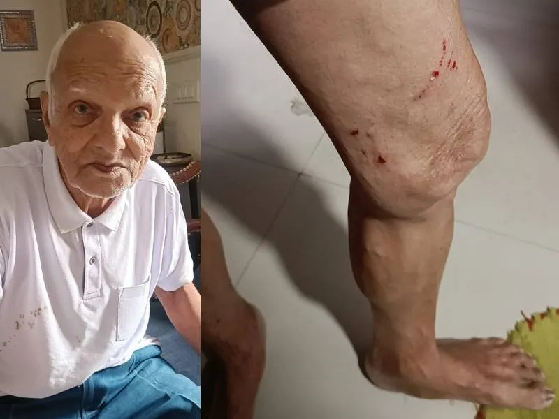 लखनऊ: बच्चे को बचाने गए बुजुर्ग को कुत्तों ने नोंचा, थम नहीं रहा आतंक, बच्चों ने निकला किया बंद