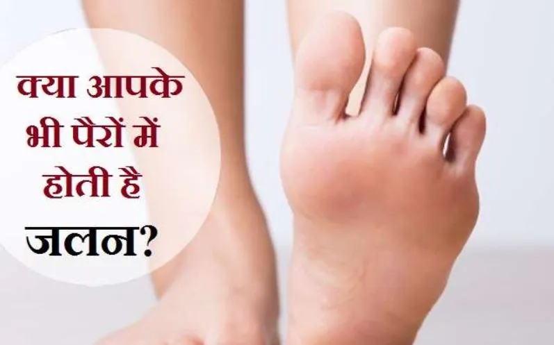 गर्मियों में होती है पैरों में जलन तो न लें टेंशन, इन टिप्स का करें इस्तेमाल...मिलेगी राहत