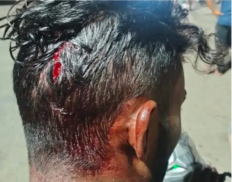 लालकुआं: नौकरी से लौट रहे युवक पर नशेड़ियों ने हमला कर सिर फोड़ डाला 