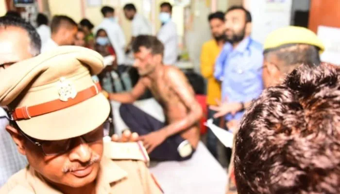 खाक छानती रही Unnao पुलिस, युवक ने CM आवास पहुंच खुद को लगाई आग, SP को फोन कर विधायक को गोली मारने की दी थी धमकी