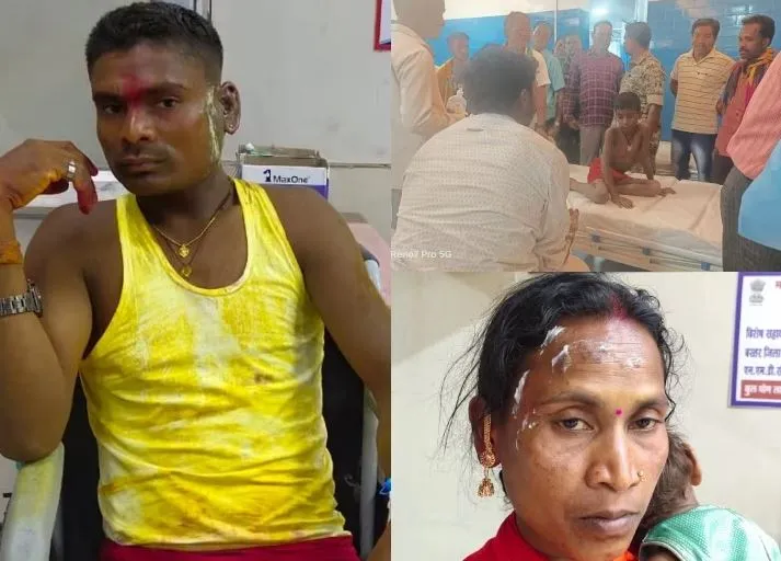 छत्तीसगढ़: एसिड अटैक दूल्हा-दुल्हन सहित 12 लोग झुलसे