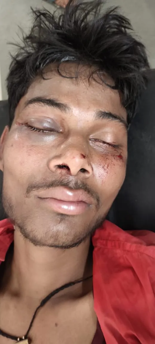 बरेली: कार से बाइक में टक्कर लगने पर चालक को जान से मारने का प्रयास