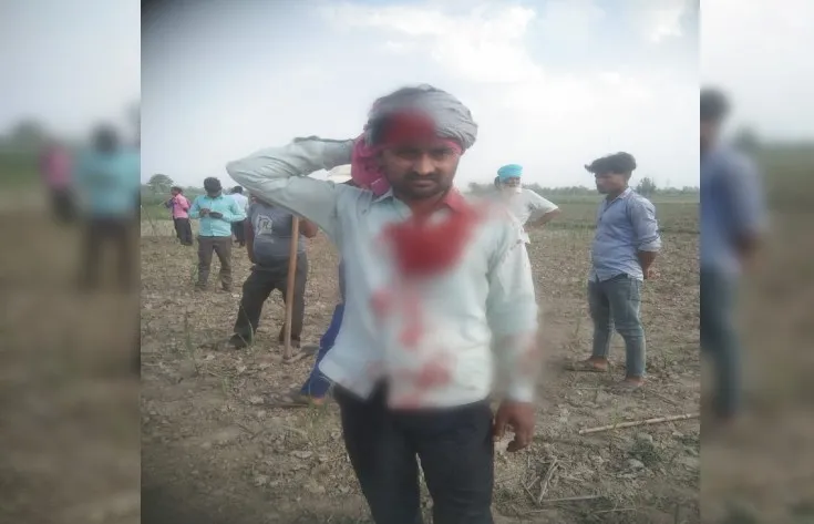 Pilibhit: खेत पर काम कर रहे किसान पर बाघ ने किया हमला, क्षेत्र में दहशत का माहौल