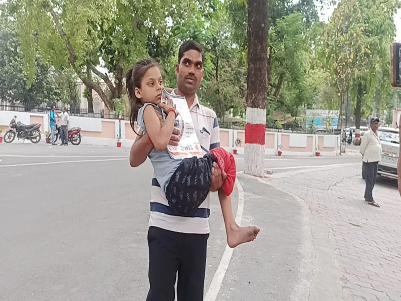बहराइच: झोलाछाप डॉक्टर के इलाज से बालिका का पैर हुआ खराब, KGMU के चिकित्सकों ने काटा