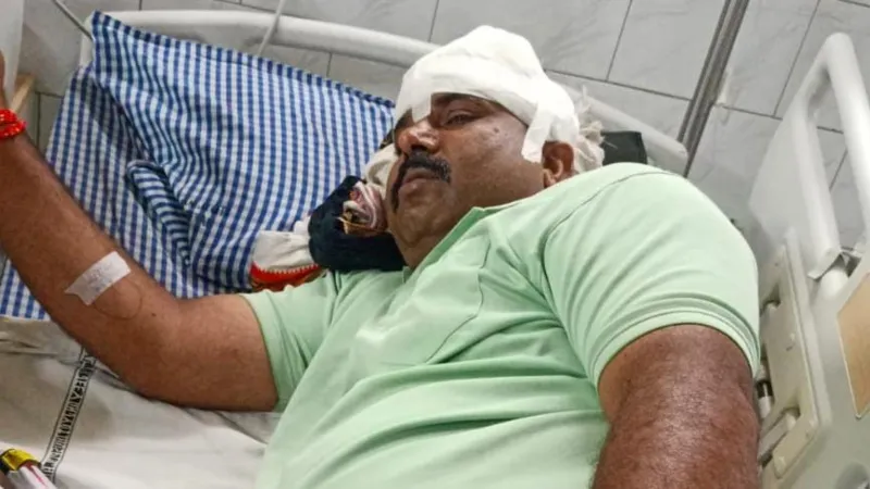 प्रयागराज : शादी समारोह से लौट रहे युवक को कार सवार लोगों ने जमकर पीटा 