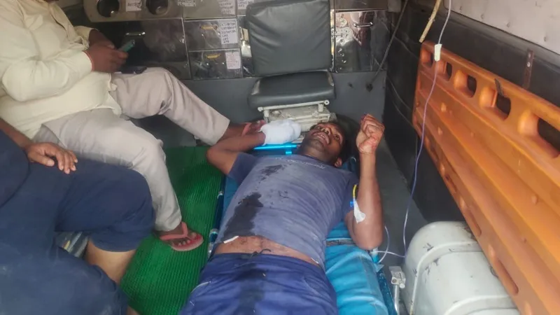 अयोध्या: रामपथ पर दुकान मरम्मत के दौरान ब्लास्ट, युवक की उंगलियां उड़ीं, हालत गंभीर