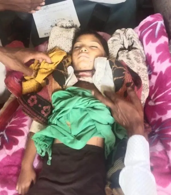 बलरामपुर : घर के पास खेल रही बच्ची पर तेंदुए ने किया हमला, बच्ची हुई घायल