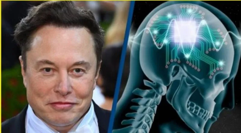 एलन मस्क का नया दावा, दिमाग में चिप लगाकर करेंगे उसे कंट्रोल!, सरकार से भी मिल गई मंजूरी