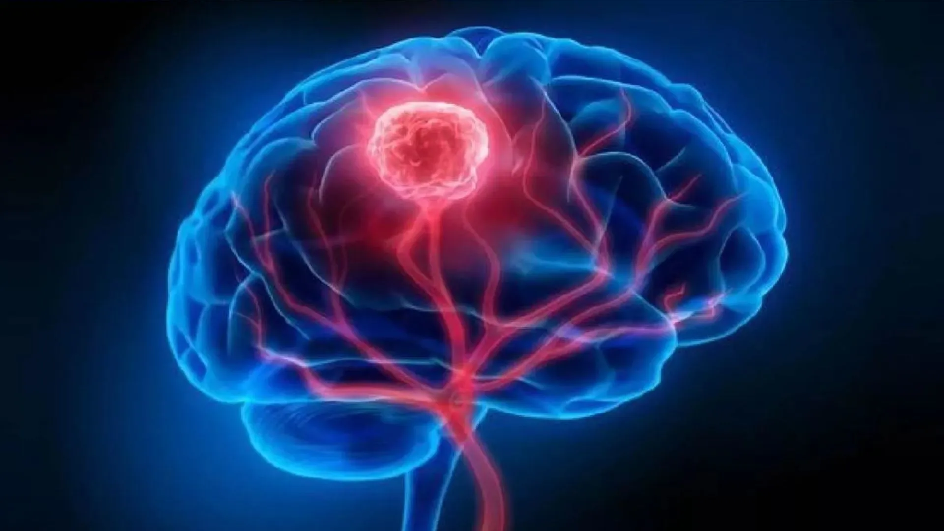 मस्तिष्क कैंसर के रोगियों के लिए मददगार हो सकती है भारतीय वैज्ञानिक की अगुवाई में हुई नई खोज 