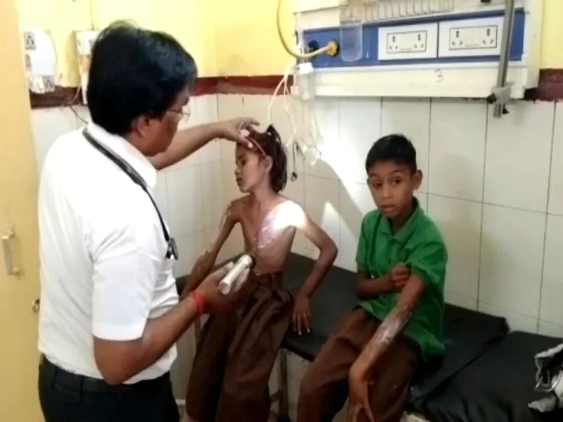 रायबरेली: स्कूल से वापस जा रहे बच्चों पर मासूम ने फेंका केमिकल, चार झुलसे 