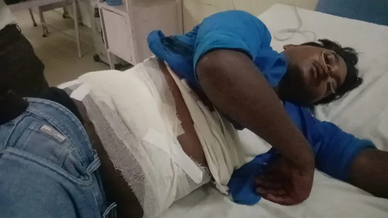 रायबरेली: रंजिश में युवक को घेरकर मारी गोली, हालत गंभीर, ट्रामा सेंटर रेफर 