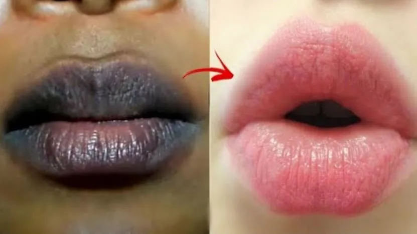 डार्क होंठों से हैं परेशान तो न लें टेंशन, पिंक बनाने के लिए अपनाएं ये घरेलू नुस्खे