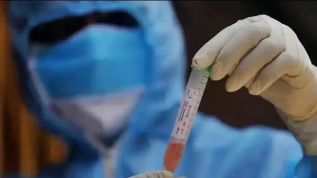 पीलीभीत: बिना सैंपल के आई रिपोर्ट, अफसर दबा गए..अब न्यायालय पहुंचा मामला