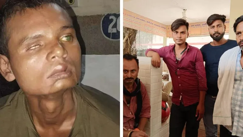 Human Trafficking : Kanpur के सुरेश मांझी की आठ माह बाद मौत, मानव तस्करों द्वारा दी गई यातनाएं नहीं कर पा रहा था बयां 