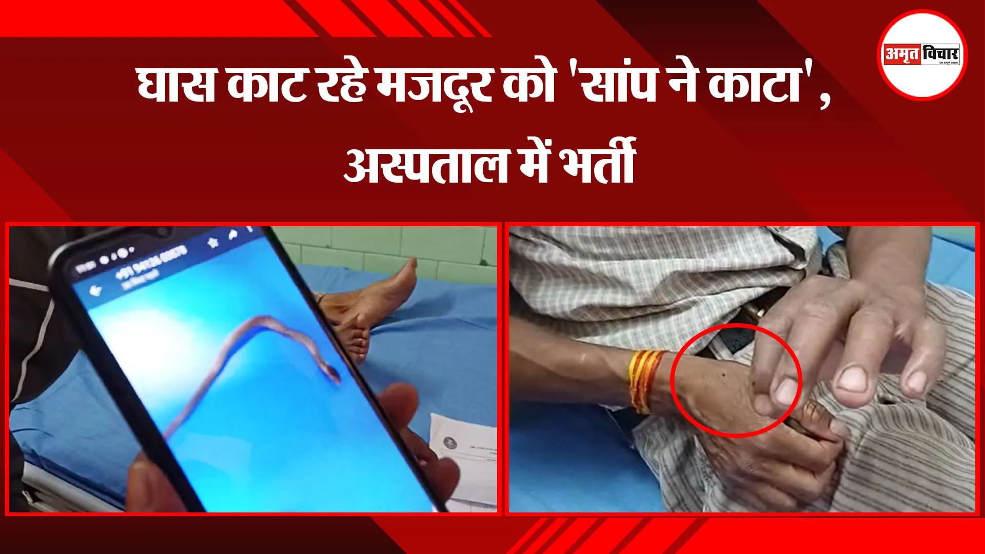 बरेली: घास काट रहे मजदूर को 'सांप ने काटा', अस्पताल में भर्ती 