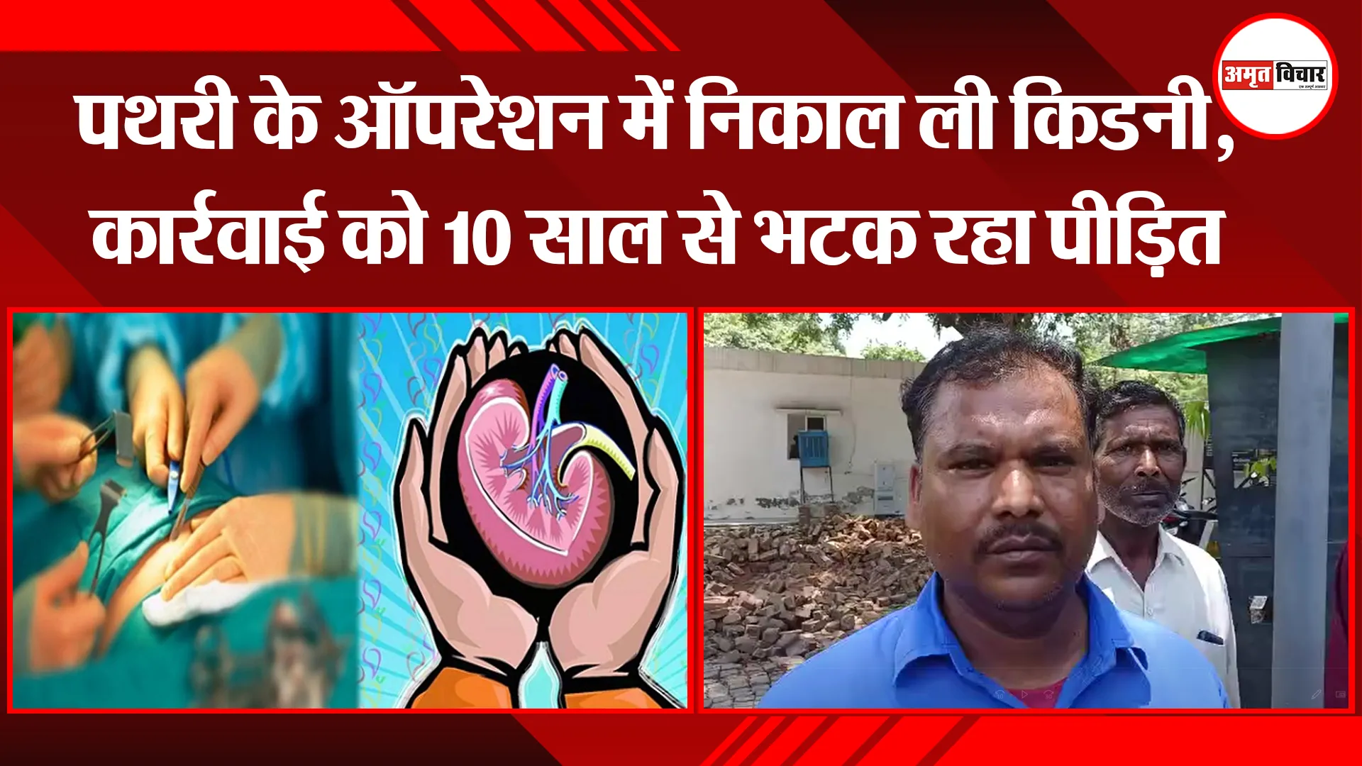 बरेली: पथरी के ऑपरेशन में निकाल ली किडनी, कार्रवाई को 10 साल से भटक रहा पीड़ित