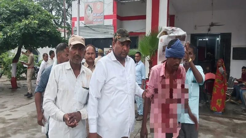 अमरोहा: लकड़ी माफिया ने वन विभाग की टीम को दौड़ा-दौड़ा कर पीटा, दो चौकीदार घायल 