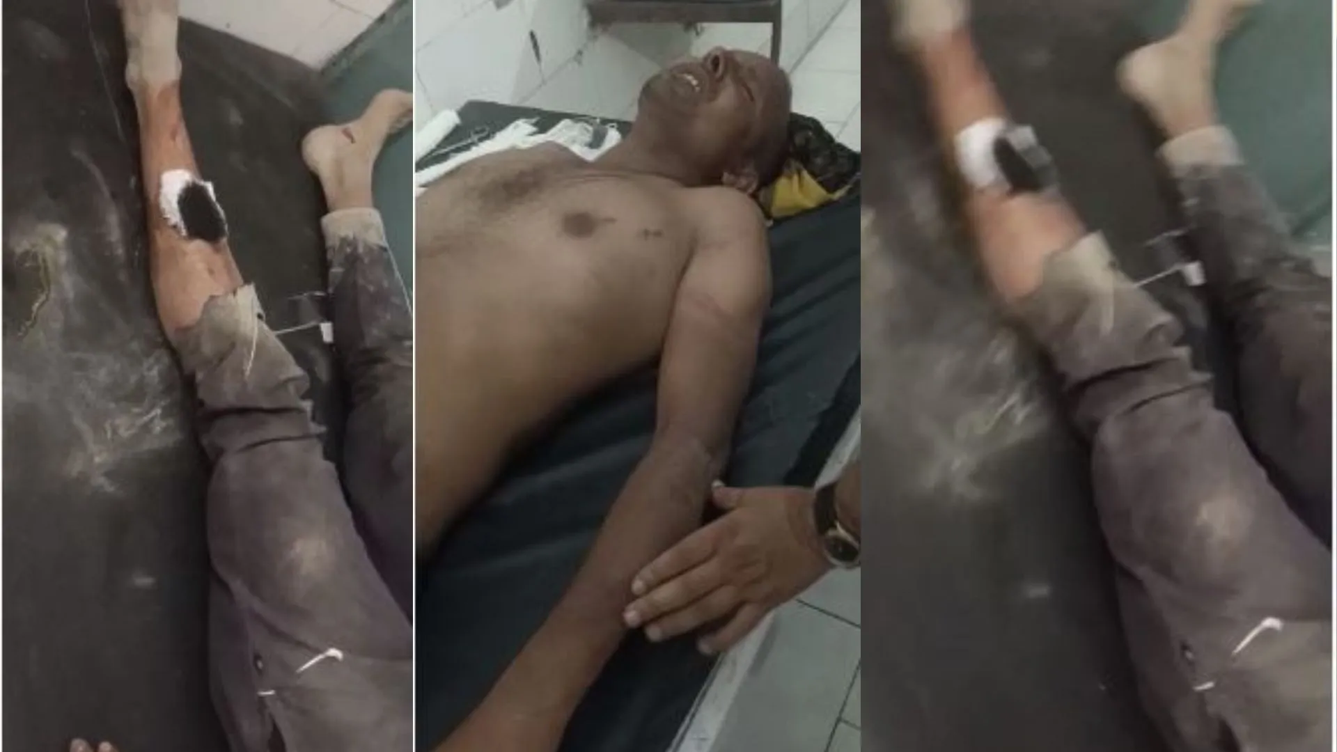 रामपुर: रंजिश के चलते हुई ताबड़तोड़ फायरिंग, जानिए पूरा मामला