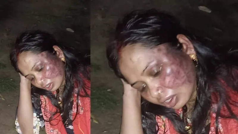 प्रयागराज: दहेज में नहीं मिला दस लाख तो ससुरालियों ने गले में फंदा डालकर विवाहिता बेरहमी से पीटा, मुकदमा दर्ज