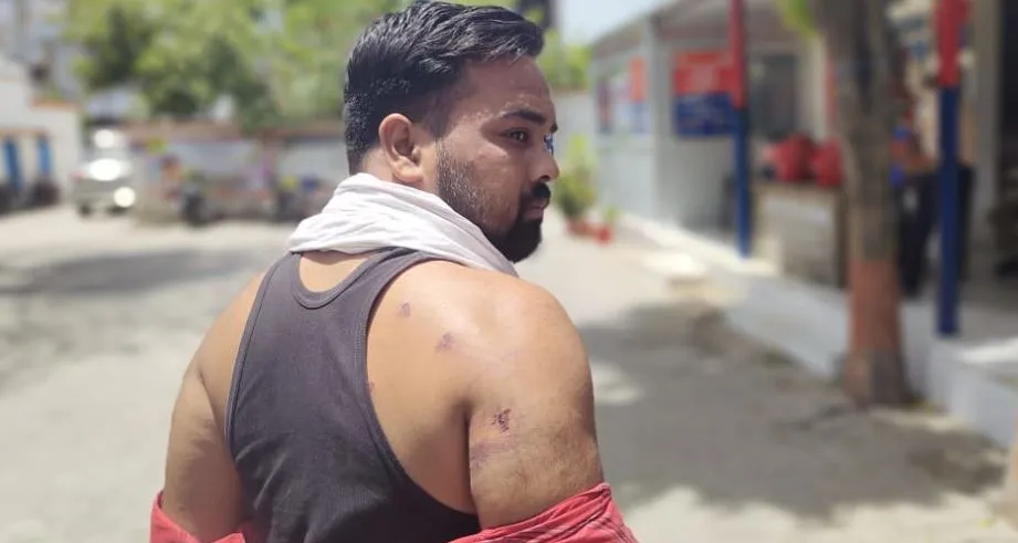 पीलीभीत: हमले में घायल छात्र का आरोप...न ठीक से मेडिकल हुआ, लिखाई मनमाफिक तहरीर, जानिए क्या है मामला 