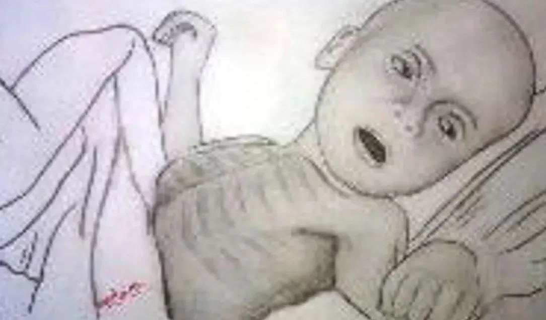 कुपोषित बच्चों के स्वास्थ्य प्रबंधन में यूपी के रामपुर ने मारी बाजी