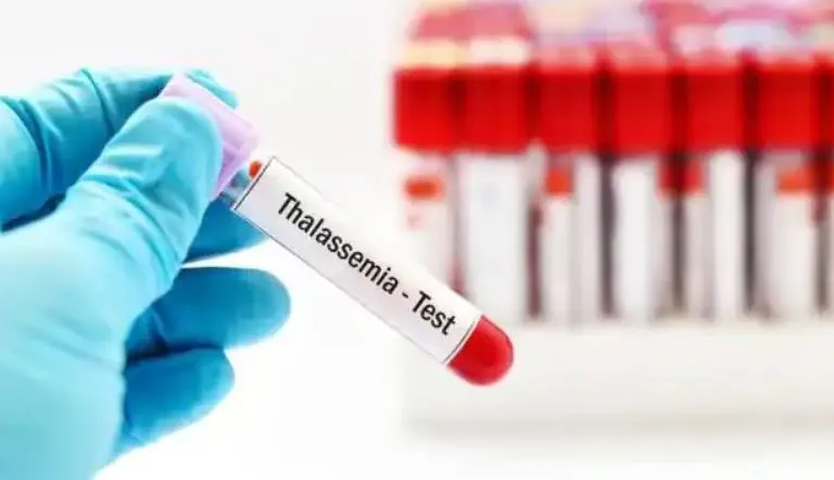 बरेली: थैलेसीमिया की दवा नहीं कर रही असर, खून में बढ़ रहा आयरन