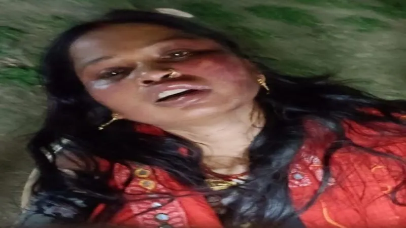 प्रयागराज : ससुराल वालों ने विवाहिता के गले को फंदे से कसा, बेरहमी से पीटा - जान बचाकर भागी  
