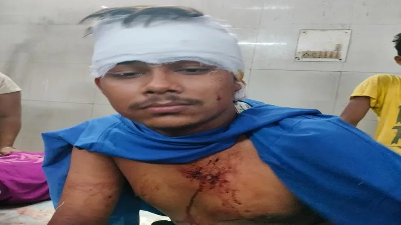 बहराइच : कुछ लोगों ने युवक पर चाकू से किया ताबड़तोड़ हमला, युवक गंभीर रूप से घायल