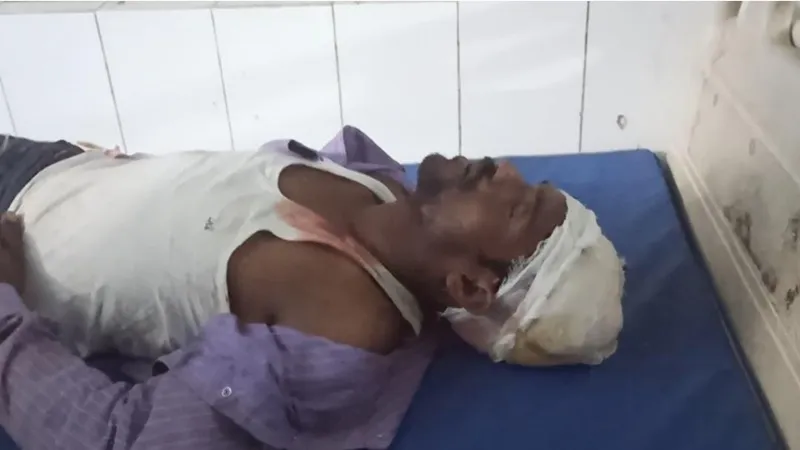 बहराइच : शटरिंग मशीन के नीचे दब कर सगे भाई हुए घायल