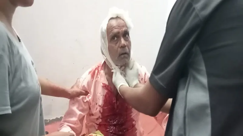 सुलतानपुर : घर लौट रहे सर्राफा व्यवसाई को स्कार्पियो सवार लोगों ने पीटा, व्यापारी गंभीर रूप से घायल