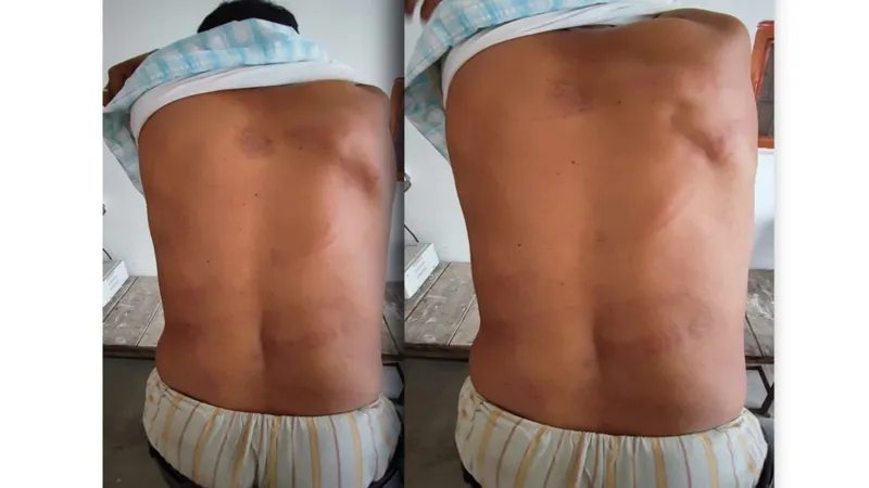 बहराइच : विद्यालय से कार्यालय जा रहे प्रधानाध्यापक पर जानलेवा हमला, केस दर्ज