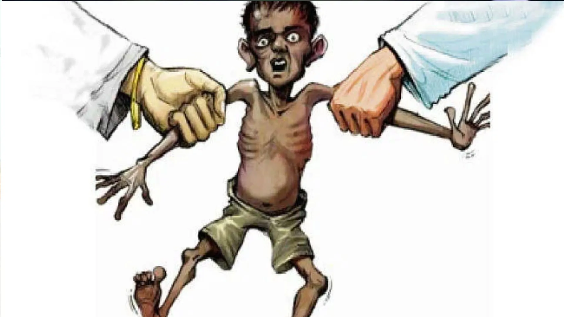 बरेली: जिम्मा नौनिहालों की सेहत सुधारने का, पर खुद कुपोषण का शिकार