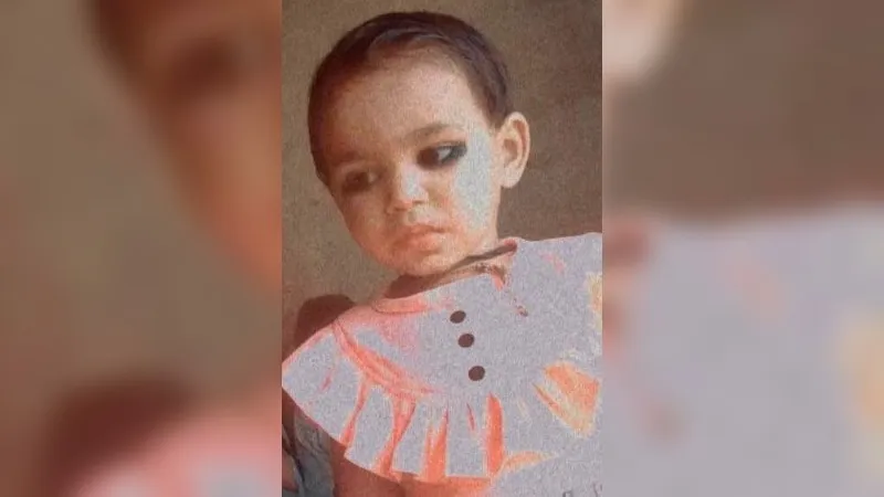 Jalaun News : पागल कुत्ते ने बच्ची को काटा, लक्ष्ण आने पर आधा सैकड़ा लोगों को बच्ची ने भी काटा, फिर हो गई मौत