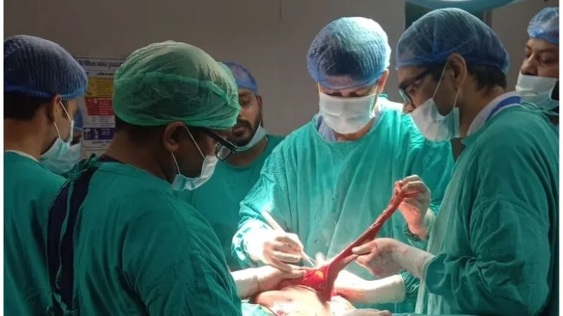 Kannauj News: कमर की सर्जरी कर निकाला साढ़े तीन किलो का ट्यूमर, मेडिकल कॉलेज की टीम ने डेढ़ घंटे में पाई सफलता