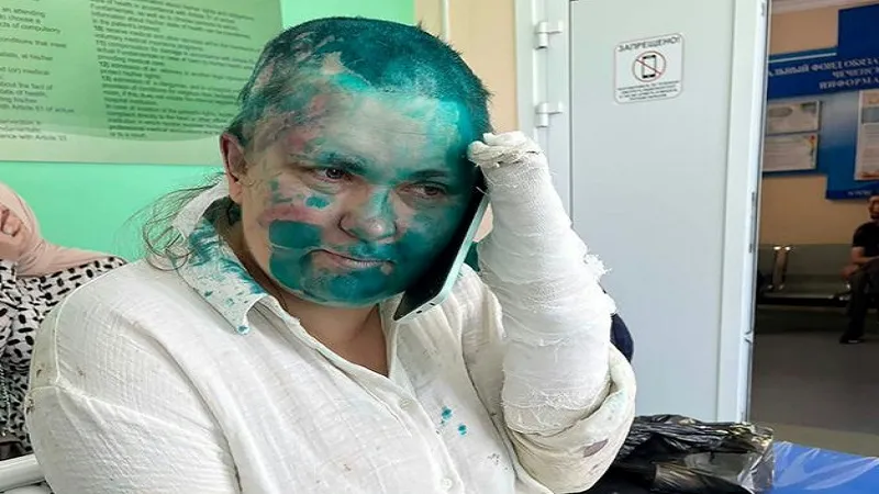 चेचन्या प्रांत में अज्ञात हमलावरों ने रूसी पत्रकार को बुरी तरह पीटा, हालत गंभीर 