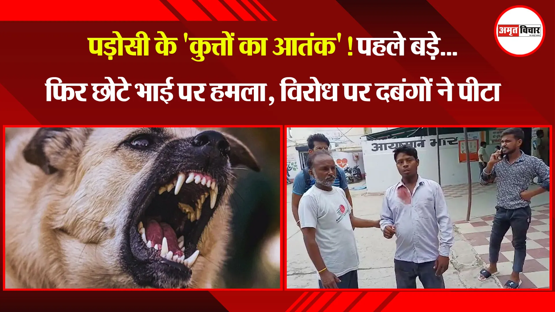 बरेली: पड़ोसी के 'कुत्तों का आतंक'! पहले बड़े...फिर छोटे भाई पर हमला, विरोध पर दबंगों ने पीटा  