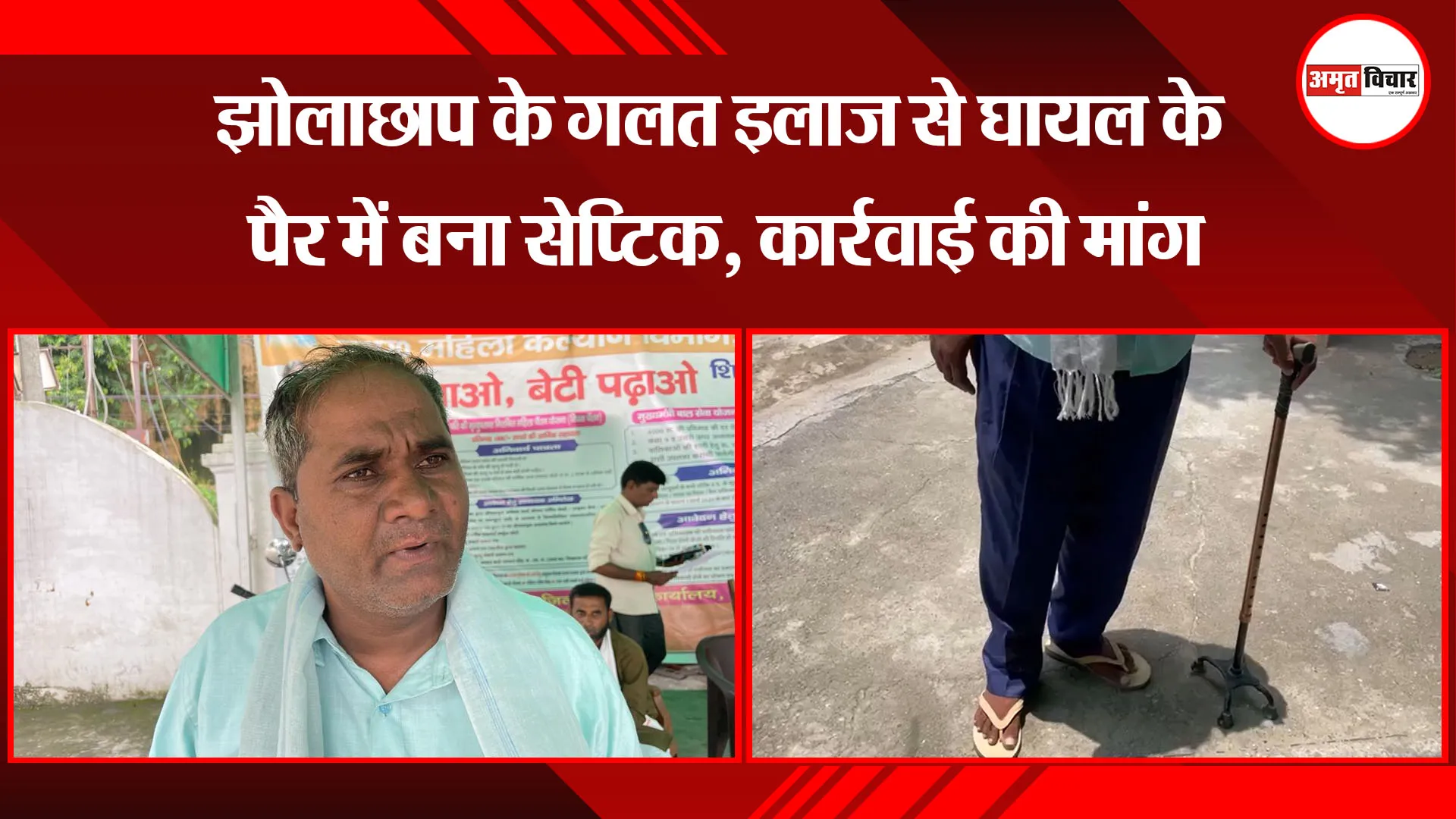 बरेली: झोलाछाप के गलत इलाज से घायल के पैर में बना सेप्टिक, कार्रवाई की मांग