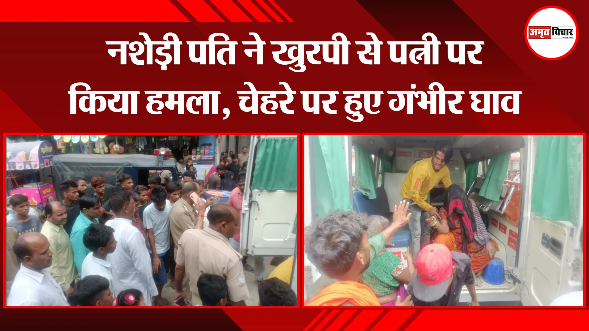 बरेली: नशेड़ी पति ने खुरपी से पत्नी पर किया हमला, चेहरे पर हुए गंभीर घाव