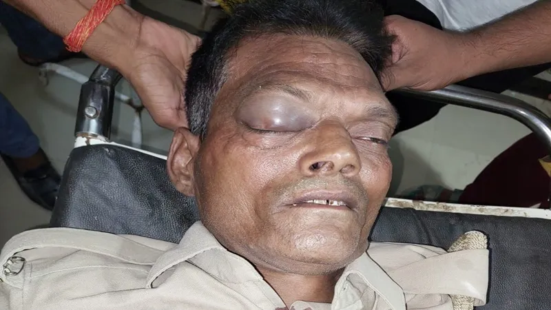 अयोध्या: ड्यूटी पर तैनात होमगार्ड जवान हादसे में हुआ घायल, एंबुलेंस स्टाफ ने बेहोशी की हालत में कराया भर्ती 