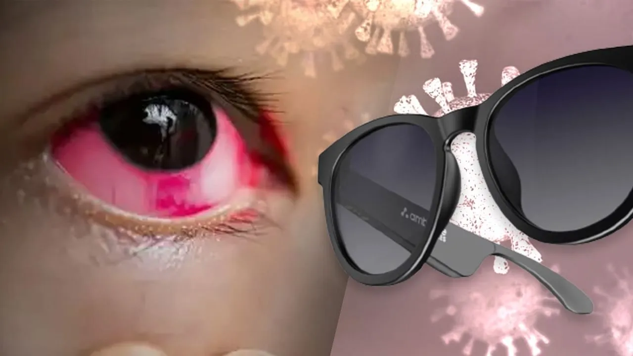 गरमपानी: आई फ्लू की चपेट में आए जवाहर नवोदय विद्यालय के 25 नौनिहाल