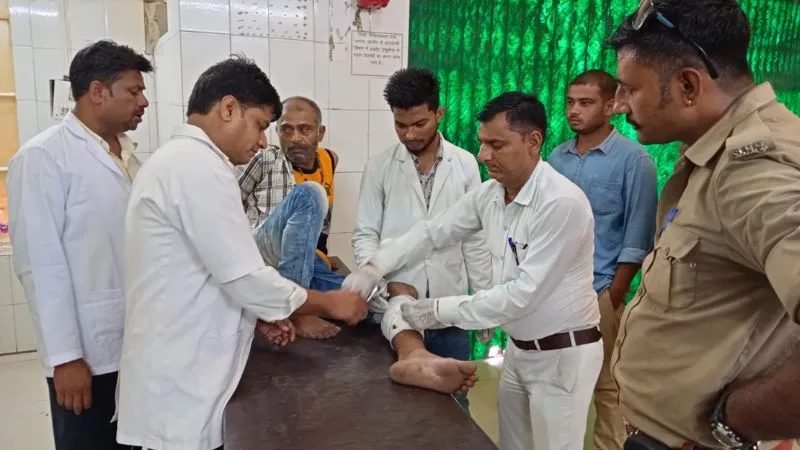 Jalaun News: पुलिस मुठभेड़ में गांजा तस्कर के पैर में लगी गोली, दूसरे ने किया सरेंडर, 50 हजार का था इनामी