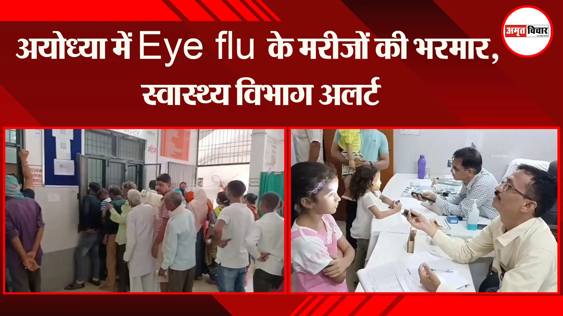 अयोध्या में Eye flu के मरीजों की भरमार, स्वास्थ्य विभाग अलर्ट