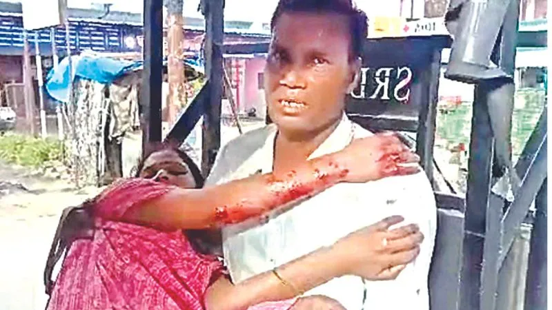 Kanpur News: बंद मकान में तेज धमाका, चपेट में आकर महिला घायल, विस्फोट के बाद एजेसियां और एटीएस सक्रिय