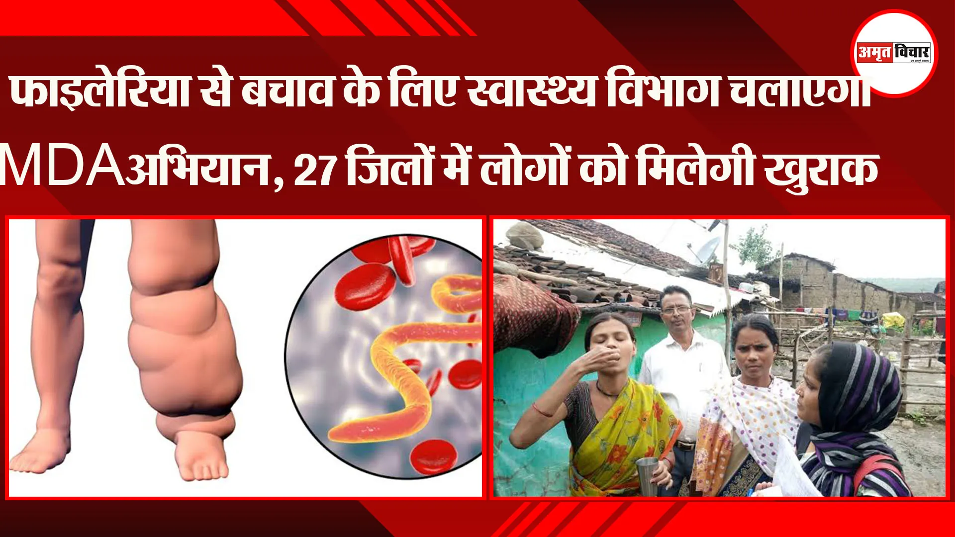 लखनऊ: फाइलेरिया से बचाव के लिए स्वास्थ्य विभाग चलाएगा MDA अभियान, 27 जिलों में लोगों को मिलेगी खुराक
