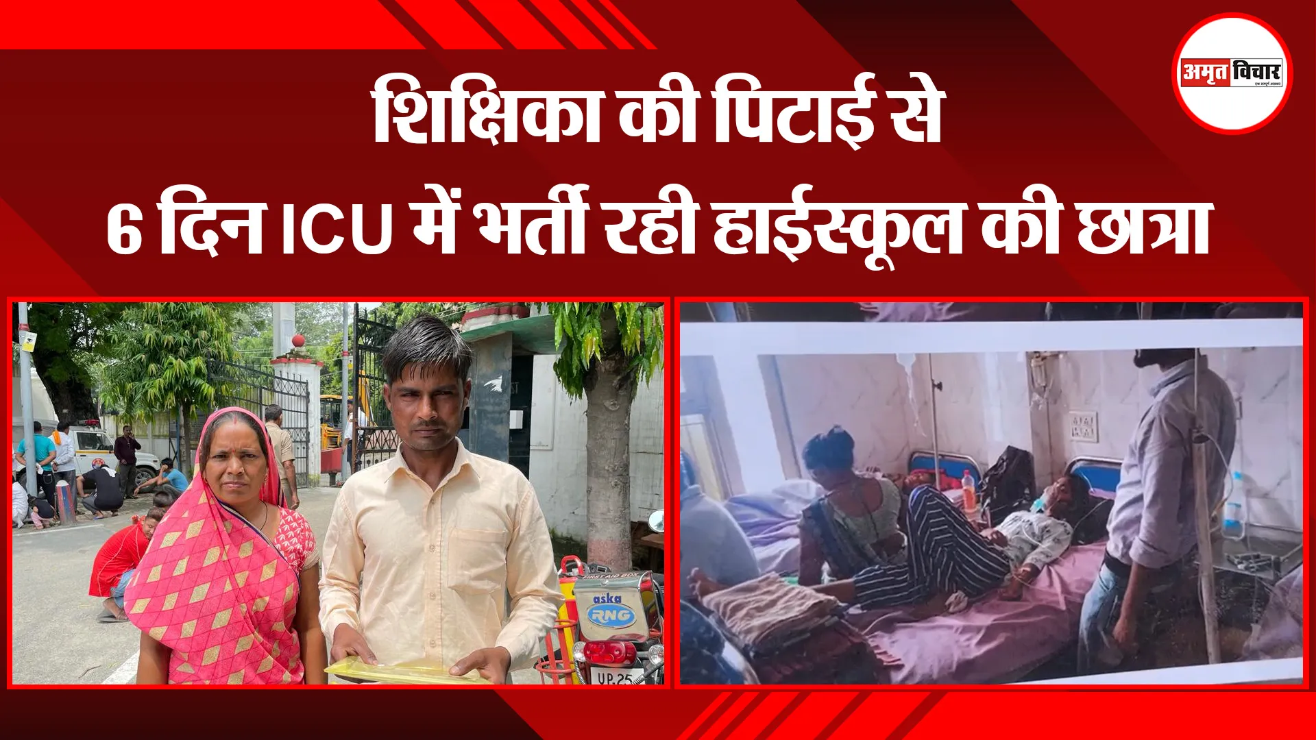 बरेली: शिक्षिका की पिटाई से 6 दिन ICU में भर्ती रही हाईस्कूल की छात्रा