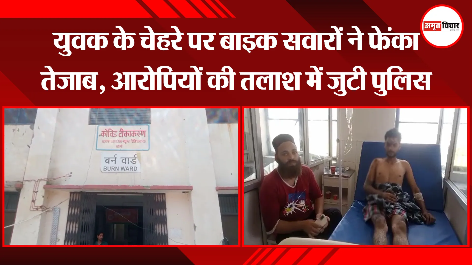बरेली: युवक के चेहरे पर बाइक सवारों ने फेंका तेजाब, आरोपियों की तलाश में जुटी पुलिस