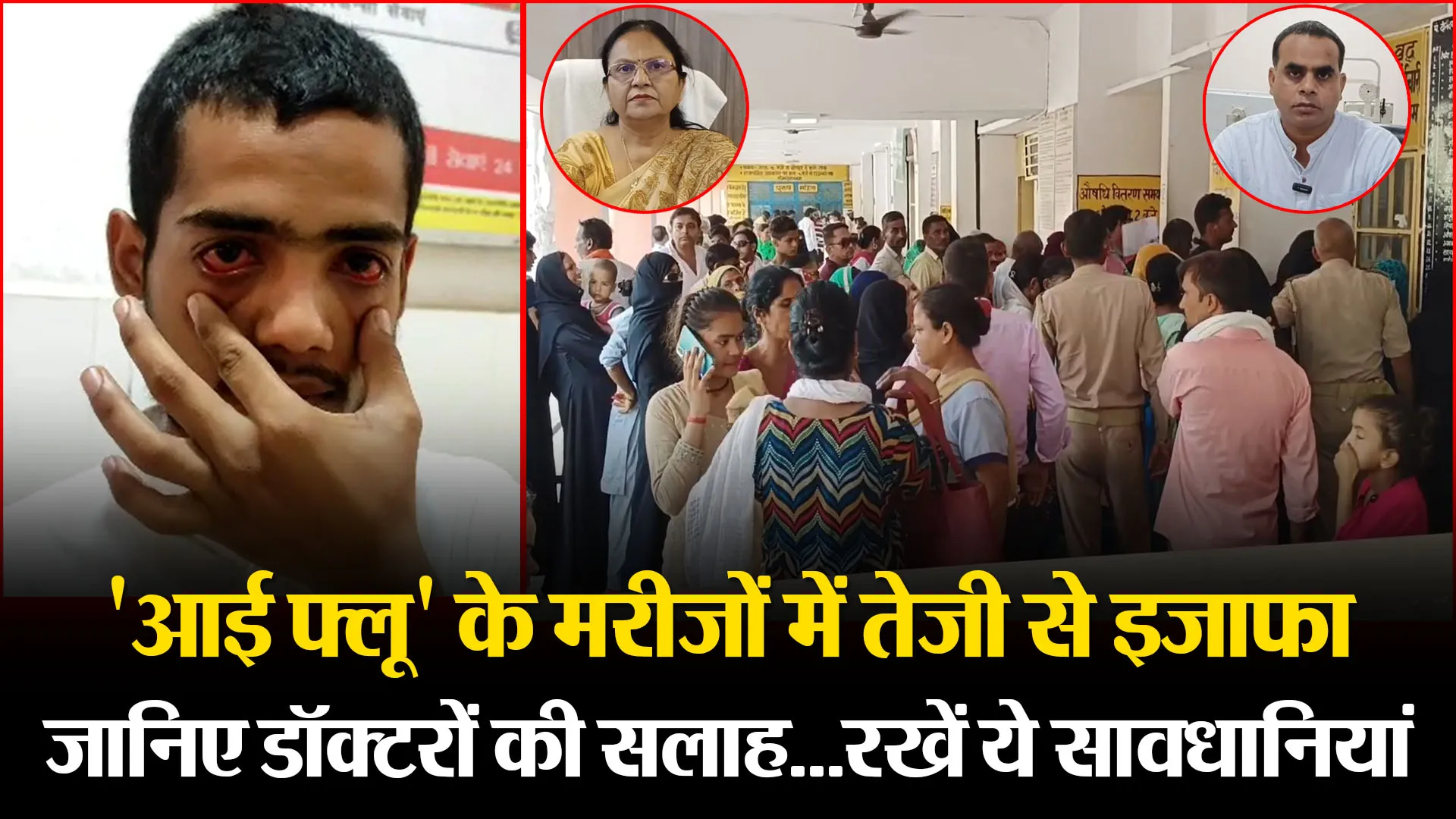 मुरादाबाद: 'आई फ्लू' के मरीजों में तेजी से इजाफा, जानिए डॉक्टरों की सलाह...रखें ये सावधानियां 